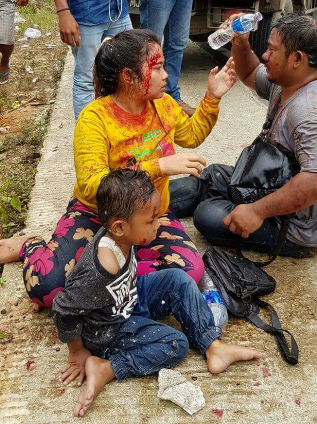Penumpang mobil Pick-up, KT 8860 MJ, ini mengalami luka berat di tubuhnya.