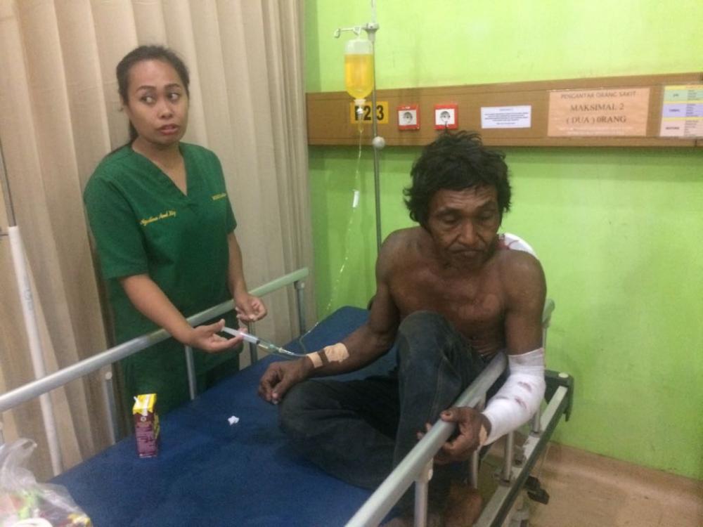 Nahas, Lengan Kiri Arman Robek Diterkam