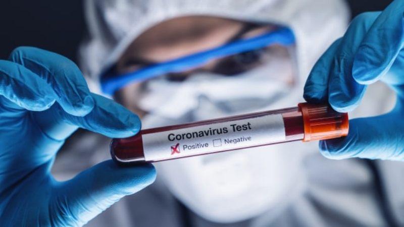 Kesampingkan HCQ, Peneliti Sebut Obat Malaria Lain Untuk Tangani Covid