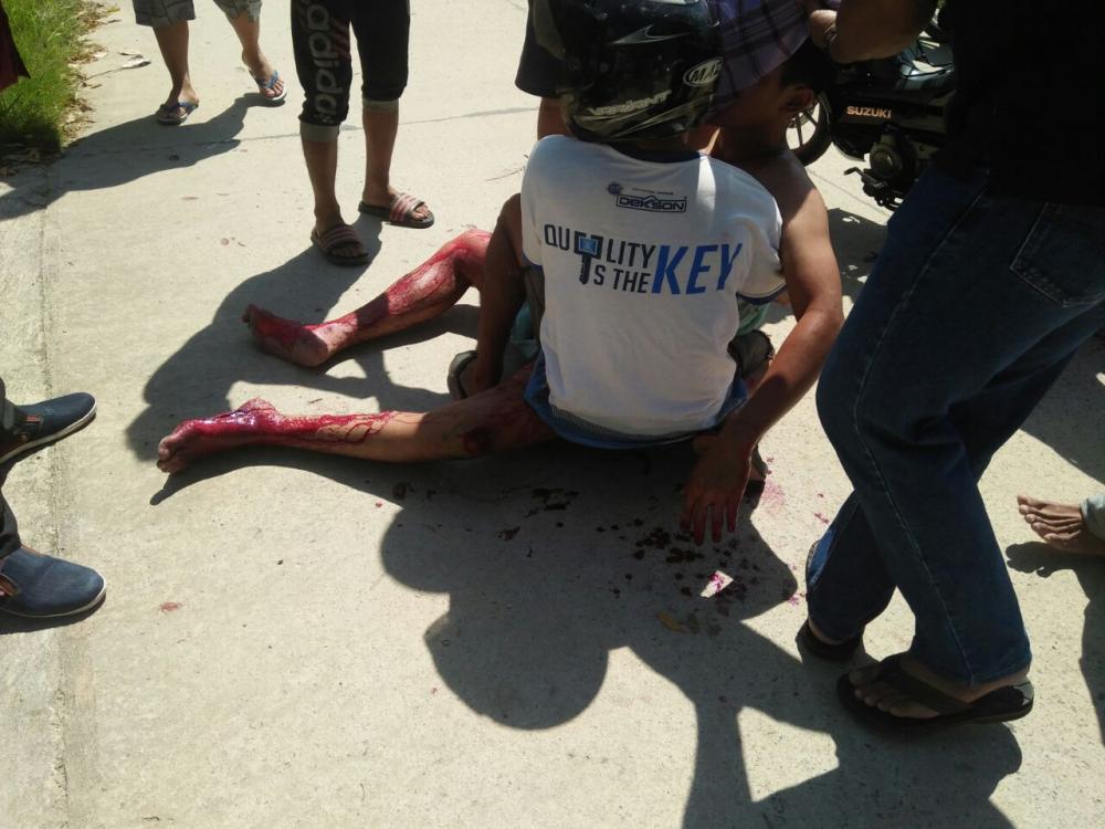 Bukan Asmara Penyebab Utama SC Nekat Iris Tubuhnya 