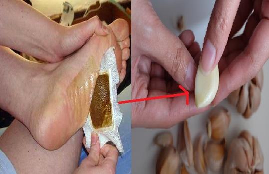 CARA HILANGKAN RACUN TUBUH HANYA DENGAN BAWANG