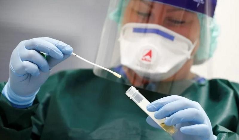 Bone Ungkap Alasan Belum Bisa Adakan Alat PCR Covid-19