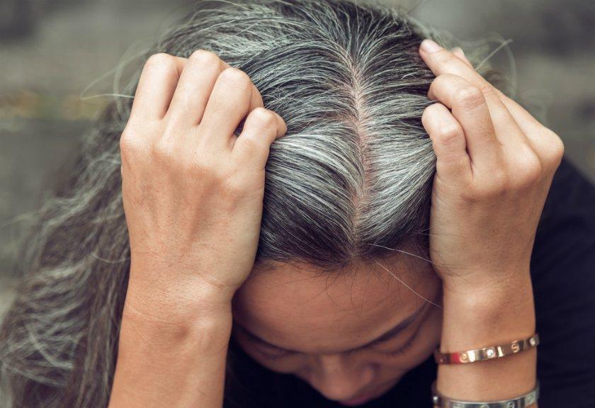 Atasi Uban dengan Kentang, Begini Caranya