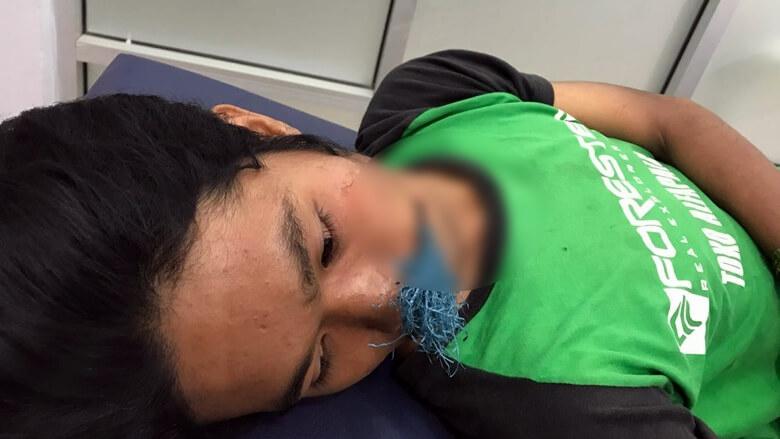 Mahasiswa IAIN Bone Diserang OTK, Busur Menancap di Pipi 