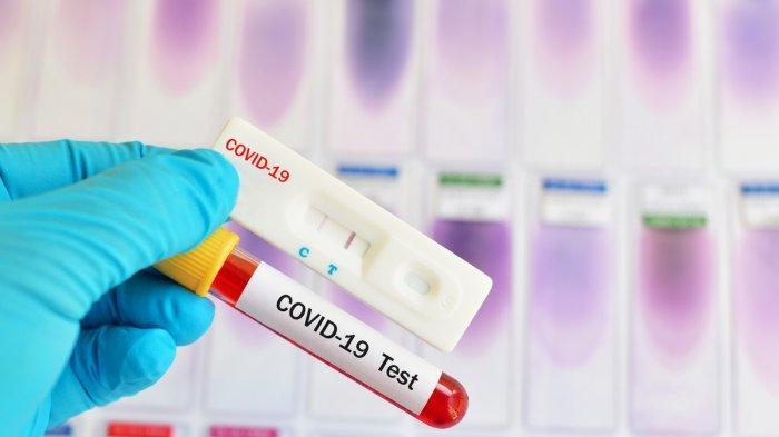 Dikeluhkan Rumah Sakit, Penyeregaman Harga Rapid Test Antigen Perlu Dievaluasi 