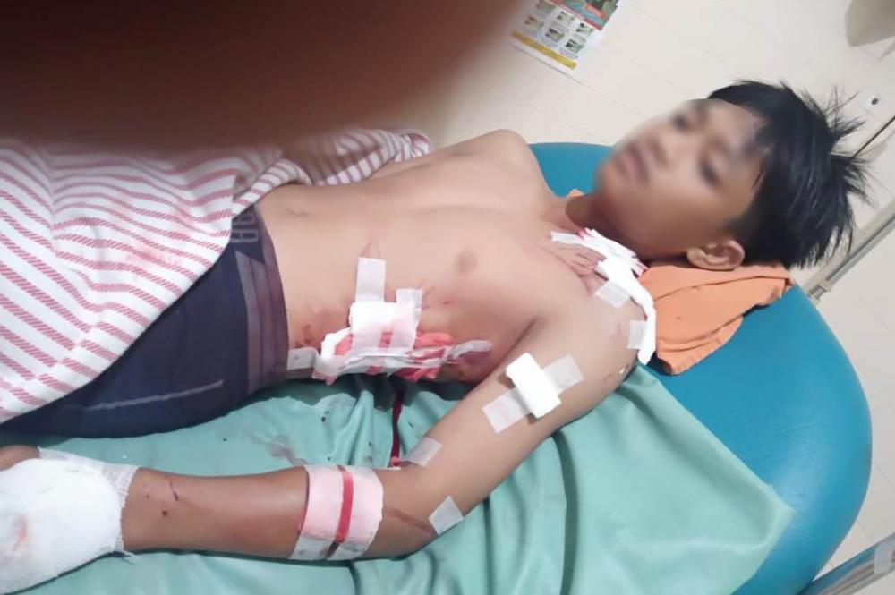 Asik Berenang, Bocah 14 Tahun di Bontang Nyaris Tewas Diterkam Buaya