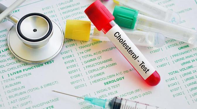 Hasil Pemeriksaan Kolesterol yang Perlu Anda Perhatikan