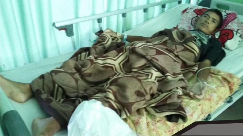 Ngeri, Banyak Paku Tajam Ditemukan dalam Perut Pria Ini