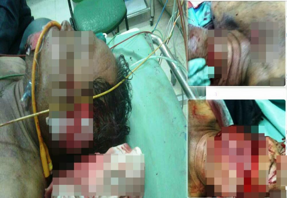 Diduga Mengalami Gangguan Jiwa, Kosim Membabi Buta Bacok Tukang Ojek