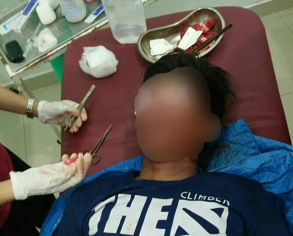 Seruduk Mobil Pete-pete, Remaja di Bawah Umur Alami Luka Serius di Wajah