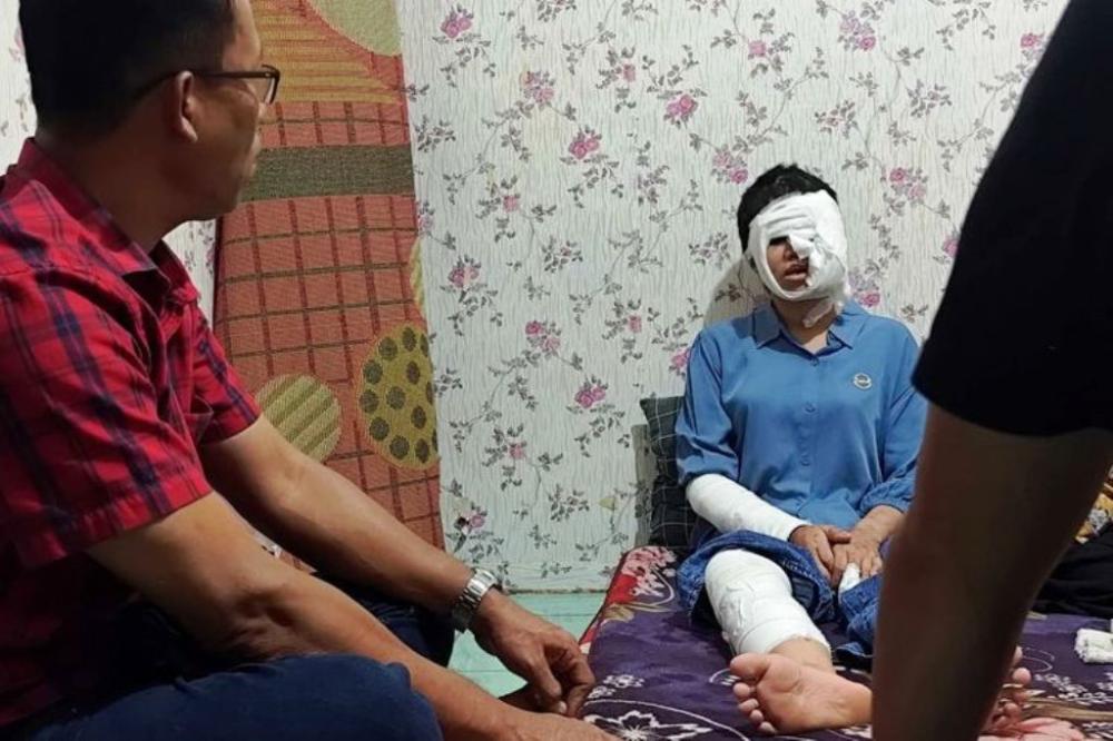 Cerita Anak di Balikpapan Disiksa Ortu Sejak Belia hingga Muka Rusak