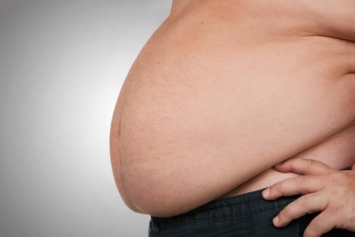 Catat, Ini Dampak Buruk Obesitas pada Kulit