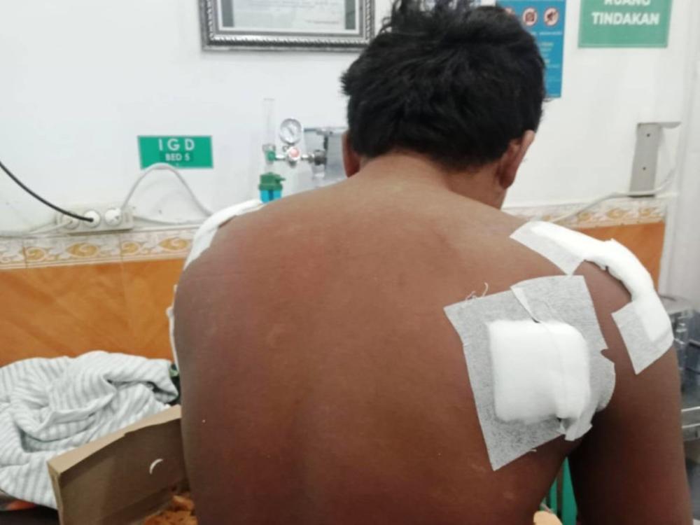 "Aku Tak Pernah Sakiti Buaya", Kisah Nelayan Bontang Selamat dari Terkaman Predator Kedindingan 