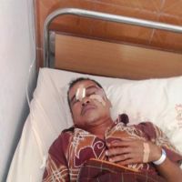 Tidak Hanya Menelan Ayam, Ular Juga "Cium" Pipi Warga