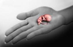 HANYA LULUSAN SMP, M, DOKTER ABORSI DIAMANKAN POLISI